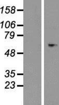 Western Blot: Serpin D1/Heparin Cofactor II Overexpression Lysate [NBP2-11151]