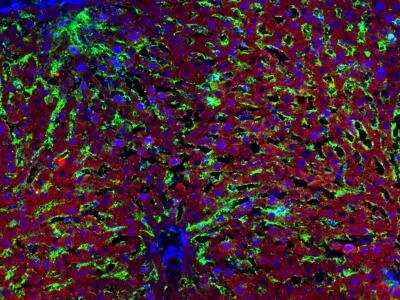 Immunohistochemistry-Frozen: Hepatic Sinusoidal Endothelial Cells Antibody (SE-1) [NB110-68095]