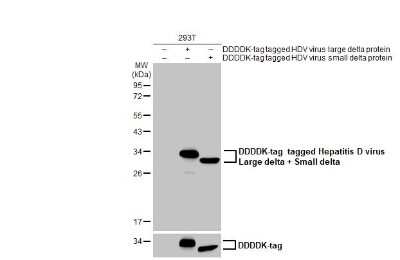 Western Blot: Hepatitis D Virus Large/Small Delta Antibody [NBP3-13460]