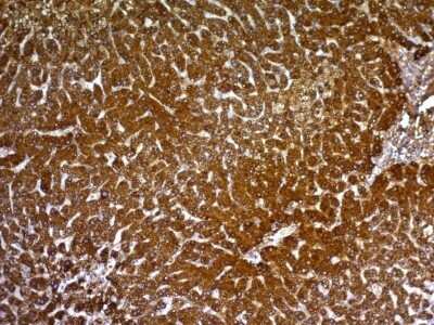 Immunohistochemistry-Paraffin: Hepatocyte Specific Antigen Antibody (HepPar1) [NBP2-45272]