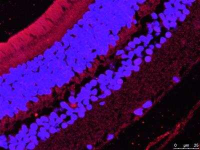 Immunohistochemistry-Paraffin: Hepcidin Antimicrobial Peptide Antibody [NBP1-59337]
