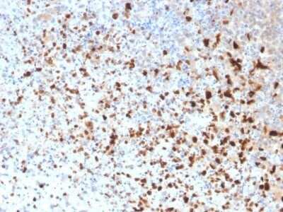 Immunohistochemistry-Paraffin: Herpes Simplex Virus 1 Antibody (10A3) [NBP3-07807]