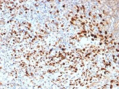 Immunohistochemistry-Paraffin: Herpes Simplex Virus 1 Antibody (HSV1/1934) [NBP3-07632]