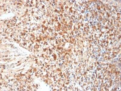 Immunohistochemistry-Paraffin: Herpes Simplex Virus 1 Antibody (HSVI/2095) [NBP3-07669]