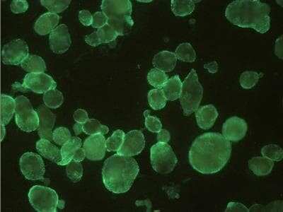 Immunocytochemistry/ Immunofluorescence: Herpes Simplex Virus 1 Antibody (T111) - BSA Free [NB500-476]