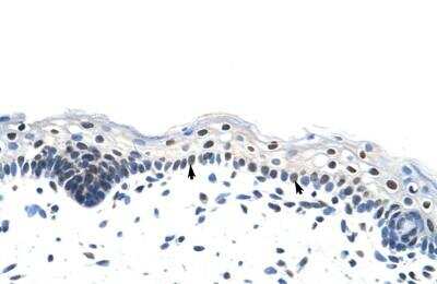 Immunohistochemistry-Paraffin: Heterogeneous Nuclear Ribonucleoprotein (A1-like) Antibody [NBP1-80446]