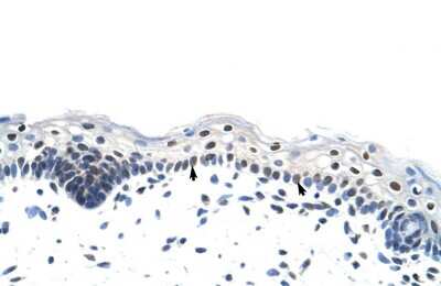 Immunohistochemistry-Paraffin: Heterogeneous Nuclear Ribonucleoprotein (A1-like) Antibody [NBP1-80446]
