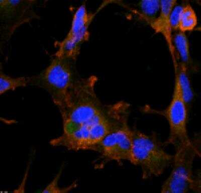 Immunocytochemistry/ Immunofluorescence: Hexanoyl-Lysine adduct Antibody (5D9) [NBP2-59362]