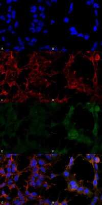 Immunocytochemistry/ Immunofluorescence: Hexanoyl-Lysine adduct Antibody (5D9) [NBP2-59362]