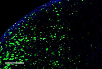 Immunohistochemistry: Hexanoyl-Lysine adduct Antibody (5D9) [NBP2-59362]