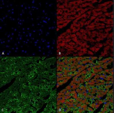 Immunohistochemistry: Hexanoyl-Lysine adduct Antibody (5D9) [NBP2-59362]