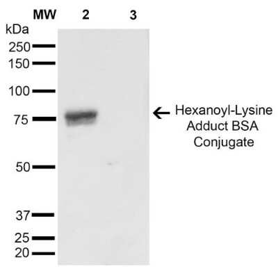 Western Blot: Hexanoyl-Lysine adduct Antibody (5D9) [NBP2-59362]