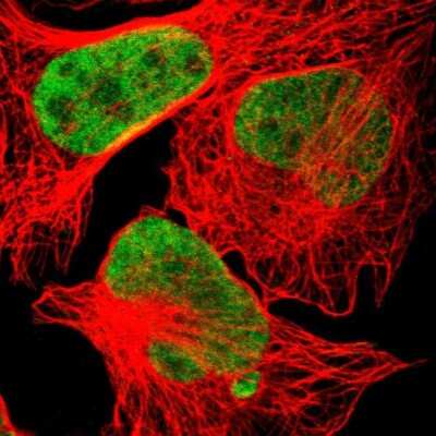 Immunocytochemistry/ Immunofluorescence: Hexim 1 Antibody [NBP1-85559]