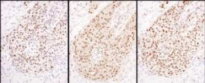 Immunohistochemistry: Hexim 1 Antibody [NBP1-71867]