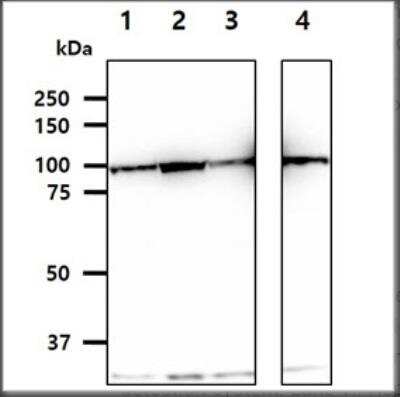 Western Blot: Hexokinase 1 Antibody (4D7)BSA Free [NBP1-04295]