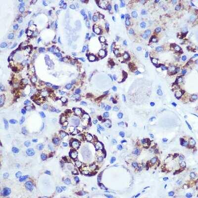 Immunohistochemistry-Paraffin: Hexokinase 1 Antibody (6B7Q2) [NBP3-15274]