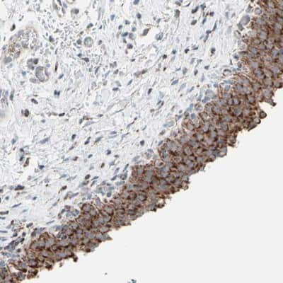 Immunohistochemistry-Paraffin: Hexokinase 1 Antibody [NBP1-87480]