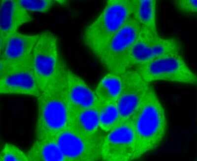 Immunocytochemistry/ Immunofluorescence: Hexokinase 1 Antibody (ST47-05) [NBP2-67503]