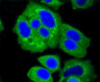 Immunocytochemistry/ Immunofluorescence: Hexokinase 1 Antibody (ST47-05) [NBP2-67503]