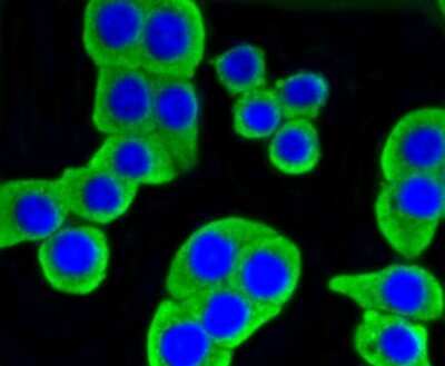 Immunocytochemistry/ Immunofluorescence: Hexokinase 1 Antibody (ST47-05) [NBP2-67503]