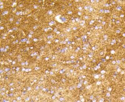 Immunohistochemistry-Paraffin: Hexokinase 1 Antibody (ST47-05) [NBP2-67503]