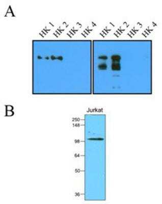 Western Blot: Hexokinase 2 Antibody (1A7)BSA Free [NBP1-04296]