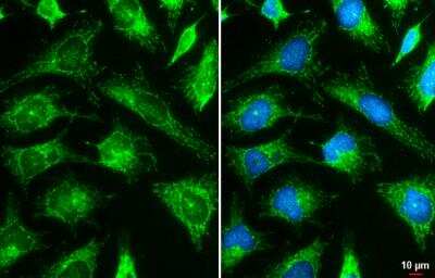 Immunocytochemistry/ Immunofluorescence: Hexokinase 2 Antibody [NBP2-16814]