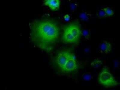Immunocytochemistry/ Immunofluorescence: Hexokinase 2 Antibody (OTI4C5) - Azide and BSA Free [NBP2-70891]