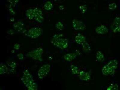 Immunocytochemistry/ Immunofluorescence: Hexokinase 2 Antibody (OTI4C5) [NBP2-02272]