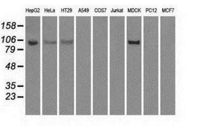 Western Blot: Hexokinase 2 Antibody (OTI4C5) [NBP2-02272]