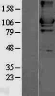 Western Blot: Hexokinase 2 Overexpression Lysate [NBL1-11579]