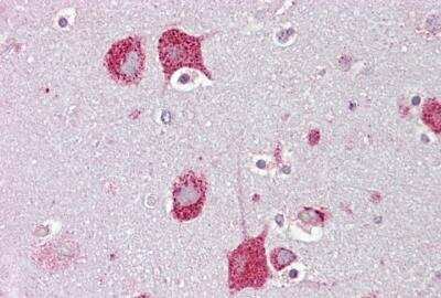 Immunohistochemistry-Paraffin: Hexosaminidase A/HEXA Antibody [NBP1-74127]