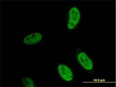 Immunocytochemistry/ Immunofluorescence: Hey L Antibody (4A11) [H00026508-M02]