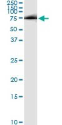 Immunoprecipitation: Hip Antibody (5D11) [H00064399-M01]