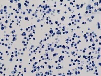 Immunohistochemistry: His Tag Antibody (RM146) [NBP2-61482]