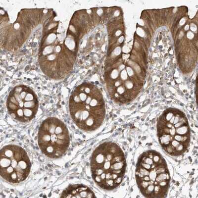 Immunohistochemistry-Paraffin: Histamine N-Methyltransferase/HNMT Antibody [NBP2-38253]