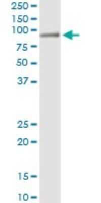 Immunoprecipitation: Histidase Antibody (4F2) [H00003034-M04]