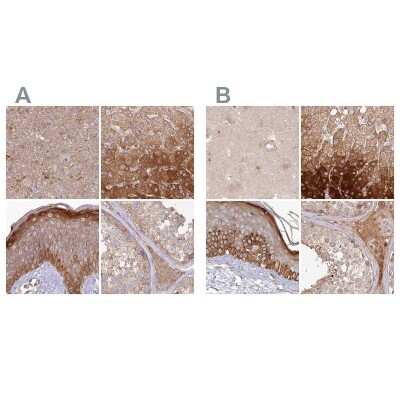 Immunohistochemistry-Paraffin: Histidase Antibody [NBP1-89695]
