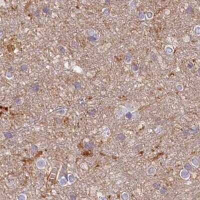 Immunohistochemistry-Paraffin: Histidase Antibody [NBP1-89695]