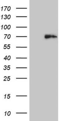 Western Blot: Histone Deacetylase 2/HDAC2 Antibody (OTI7E10) [NBP2-45949]