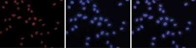 Immunocytochemistry/ Immunofluorescence: Histone Deacetylase 2/HDAC2 Antibody (C.15200201) [NBP2-59269]