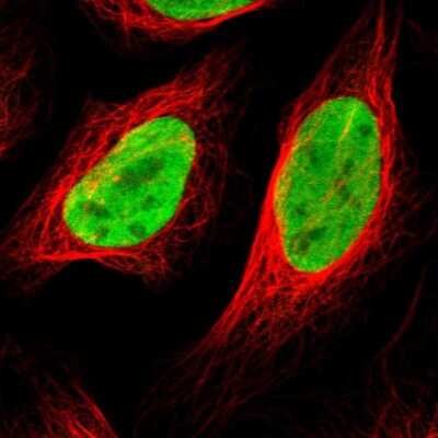 Immunocytochemistry/ Immunofluorescence: Histone Deacetylase 2/HDAC2 Antibody [NBP1-87109]