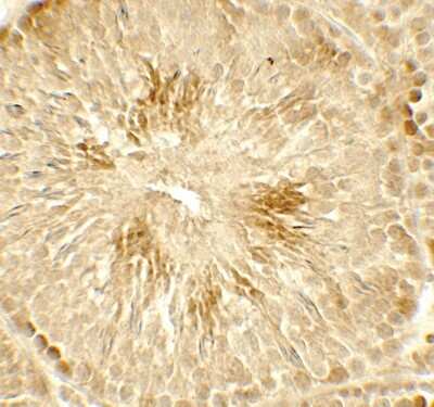 Immunohistochemistry: Histone Deacetylase 2/HDAC2 Antibody - BSA Free [NBP2-41285]