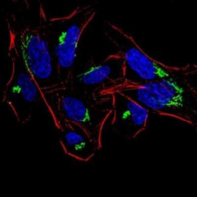 Immunocytochemistry/ Immunofluorescence: Histone Deacetylase 4/HDAC4 Antibody (7E2E6) - BSA Free [NBP2-52481]