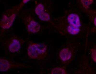 Immunocytochemistry/ Immunofluorescence: Histone Deacetylase 4/HDAC4 Antibody [NBP2-03981]