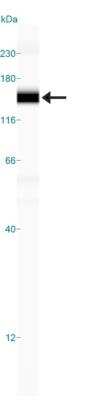 Simple Western: Histone Deacetylase 4/HDAC4 AntibodyBSA Free [NBP2-22151]