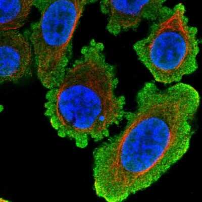 Immunocytochemistry/ Immunofluorescence: Histone Deacetylase 8/HDAC8 Antibody [NBP2-14085]