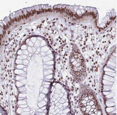 Immunohistochemistry-Paraffin: Histone Deacetylase 8/HDAC8 Antibody [NBP2-14085]