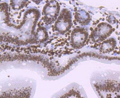 Immunohistochemistry-Paraffin: Histone H1.2 Antibody (JU43-48) [NBP2-75932]