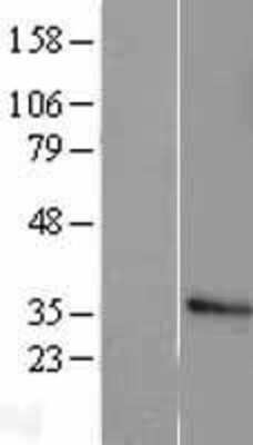 Western Blot: Histone H1.2 Overexpression Lysate [NBL1-11553]